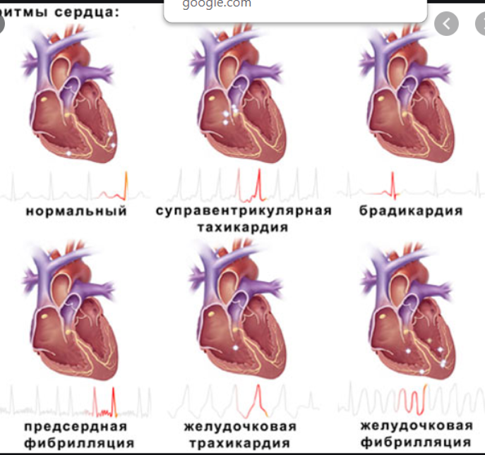 Электрическая система сердца