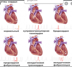 Фото как бьется сердце